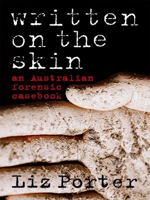 cover image of Written on the Skin